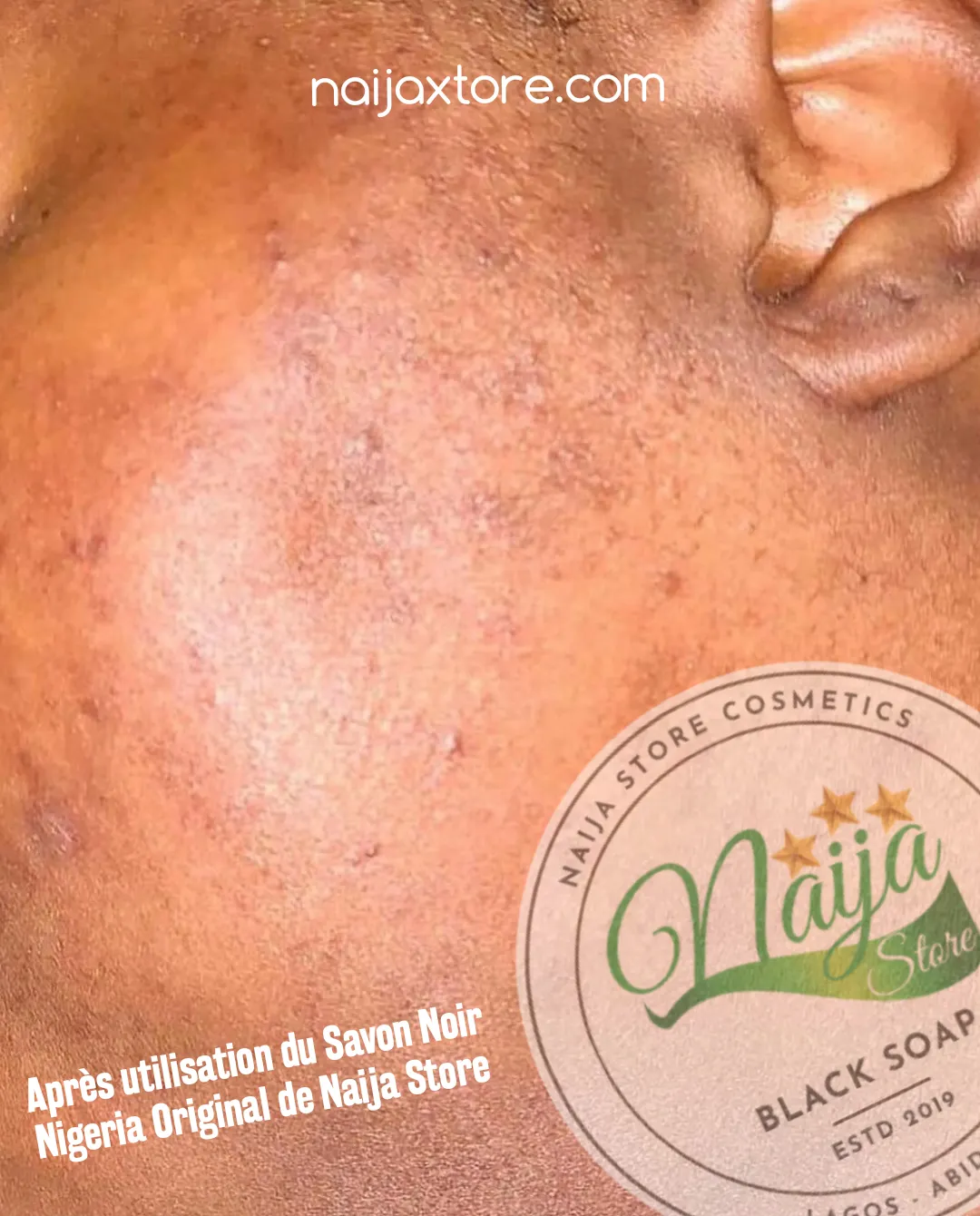 Après utilisation du Savon Noir Nigeria