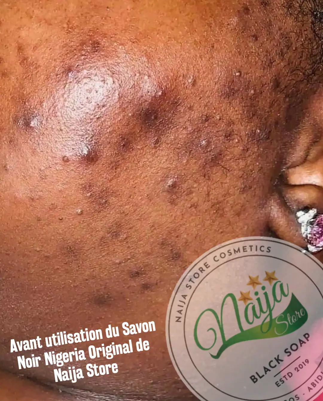 Avant utilisation du Savon Noir Nigeria